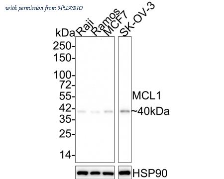 HUABIO ET1606-14 image 2
