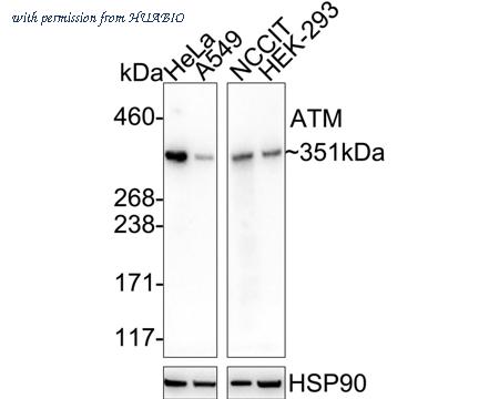 HUABIO ET1606-20 image 1