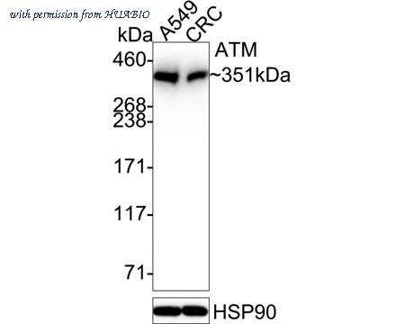 HUABIO ET1606-20 image 2