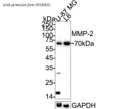 HUABIO ET1606-4 image 1