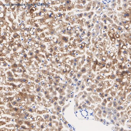 HUABIO ET1606-4 image 2