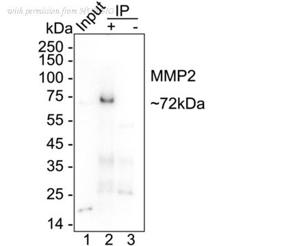 HUABIO ET1606-4 image 3