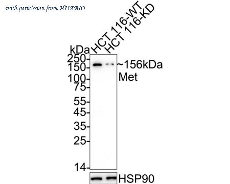 HUABIO ET1606-45 image 1