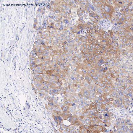 HUABIO ET1606-45 image 3