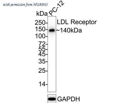 HUABIO ET1606-47-50UL image 2