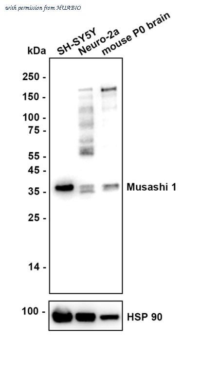 HUABIO ET1606-51 image 1