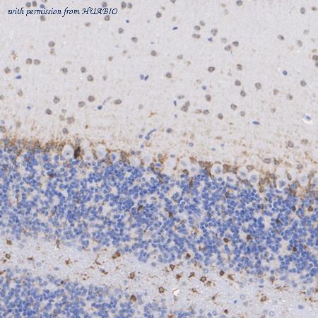 HUABIO ET1606-51 image 2