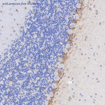 HUABIO ET1606-51 image 3