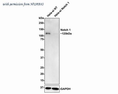 HUABIO ET1606-55-50UL image 3
