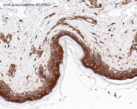 HUABIO ET1607-12 image 3