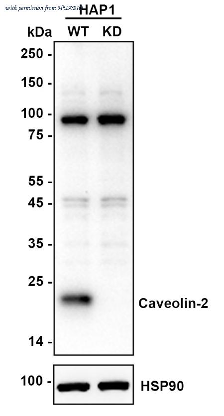 HUABIO ET1607-15 image 1
