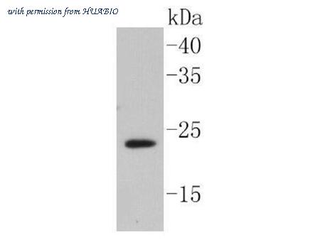 HUABIO ET1607-15 image 2