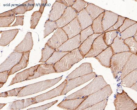 HUABIO ET1607-16 image 3