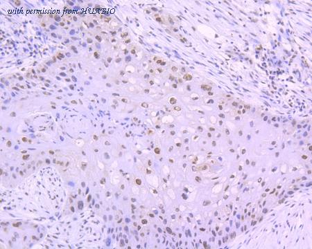 HUABIO ET1607-34 image 2