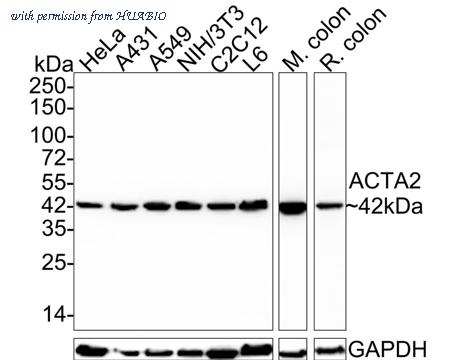 HUABIO ET1607-43 image 1