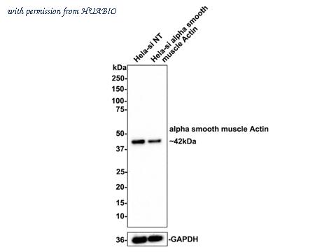 HUABIO ET1607-43 image 3