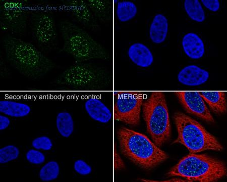HUABIO ET1607-51 image 3