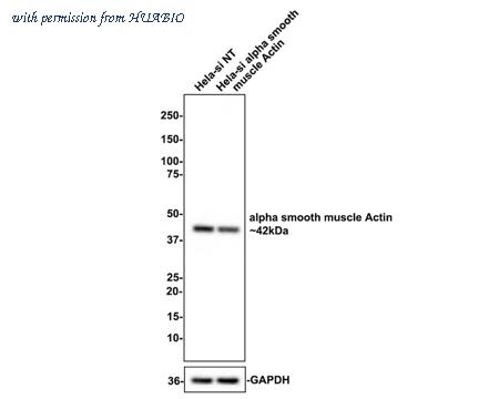 HUABIO ET1607-53-50UL image 2