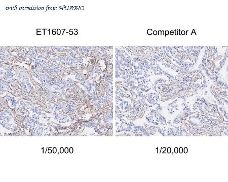 HUABIO ET1607-53-50UL image 3