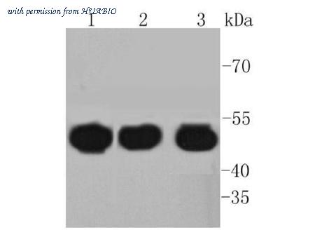 HUABIO ET1607-7 image 1