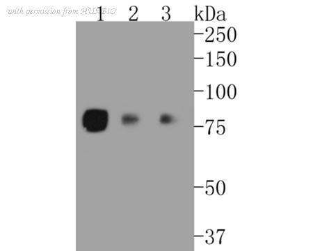HUABIO ET1608-11 image 1