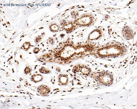 HUABIO ET1608-11 image 3