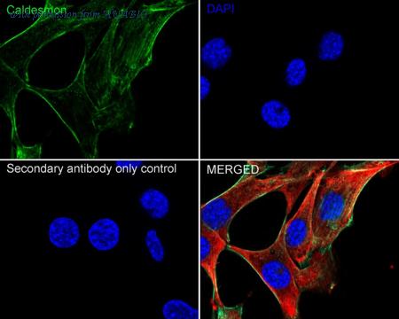 HUABIO ET1608-16 image 2