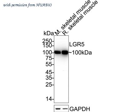 HUABIO ET1608-18 image 1