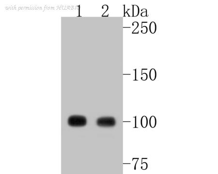 HUABIO ET1608-18 image 2