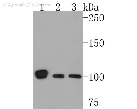 HUABIO ET1608-18 image 3
