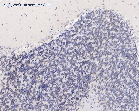 HUABIO ET1608-19 image 2