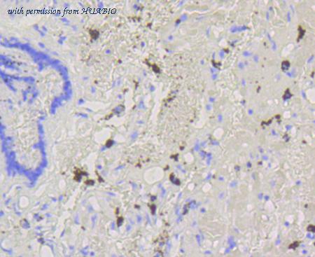 HUABIO ET1608-20 image 2