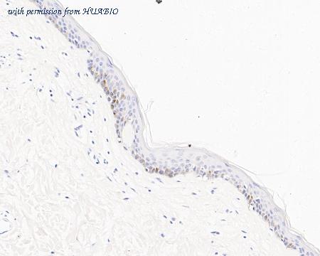 HUABIO ET1608-20 image 3