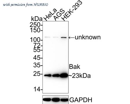 HUABIO ET1608-21 image 1