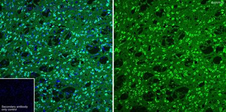 HUABIO ET1608-23 image 1