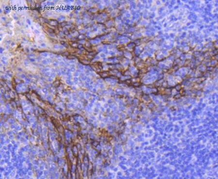 HUABIO ET1608-26 image 3