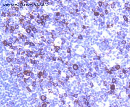 HUABIO ET1608-27 image 2