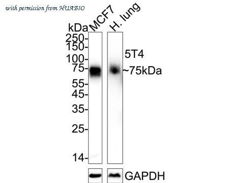 HUABIO ET1608-37 image 1