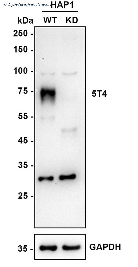 HUABIO ET1608-37 image 3