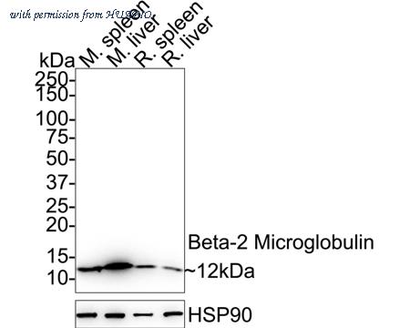 HUABIO ET1608-45 image 1