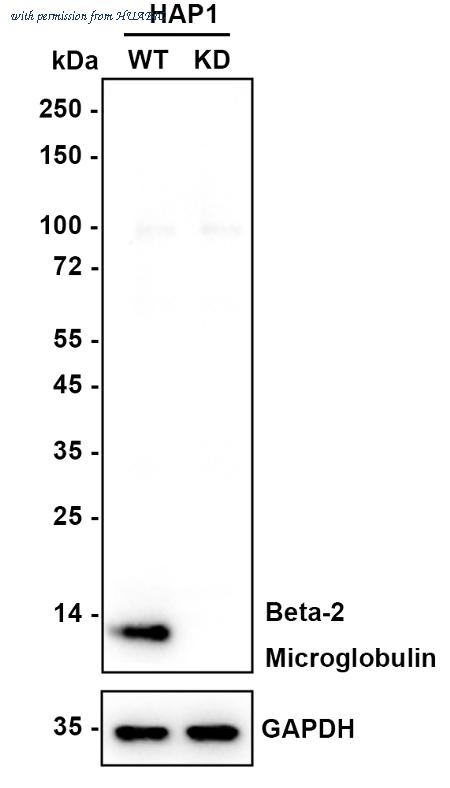 HUABIO ET1608-45 image 2