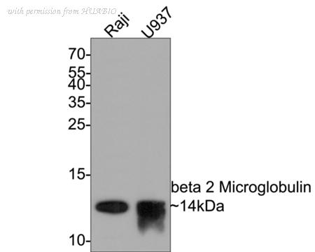 HUABIO ET1608-45 image 3