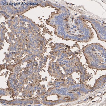 HUABIO ET1608-49-50UL image 3