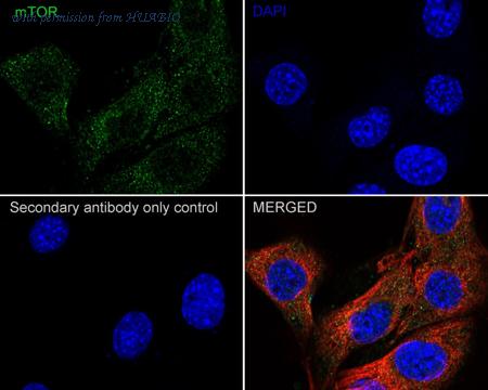 HUABIO ET1608-5 image 3