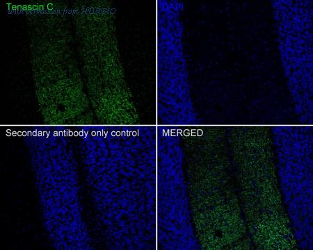 HUABIO ET1608-50 image 2