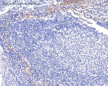 HUABIO ET1608-50 image 3