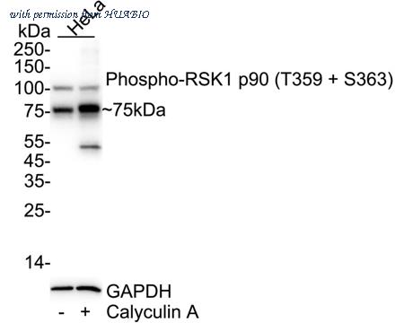 HUABIO ET1608-53 image 1
