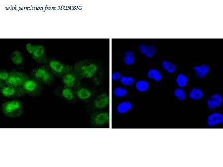 HUABIO ET1608-53 image 2