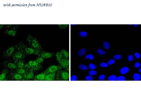 HUABIO ET1608-53 image 3