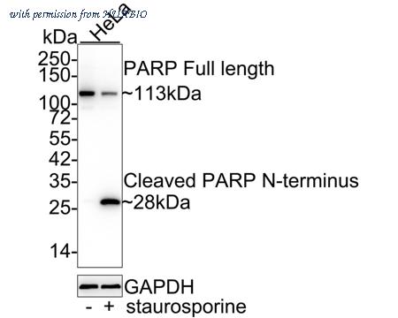 HUABIO ET1608-56 image 2